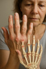 Verlicht je handen: praktische tips tegen arthrose main