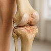 Leven zonder beperkingen: zo versla je arthrose!