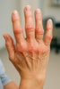 Verlicht de pijn van arthrose des doigts met natuurlijke remedies en slimme tips
